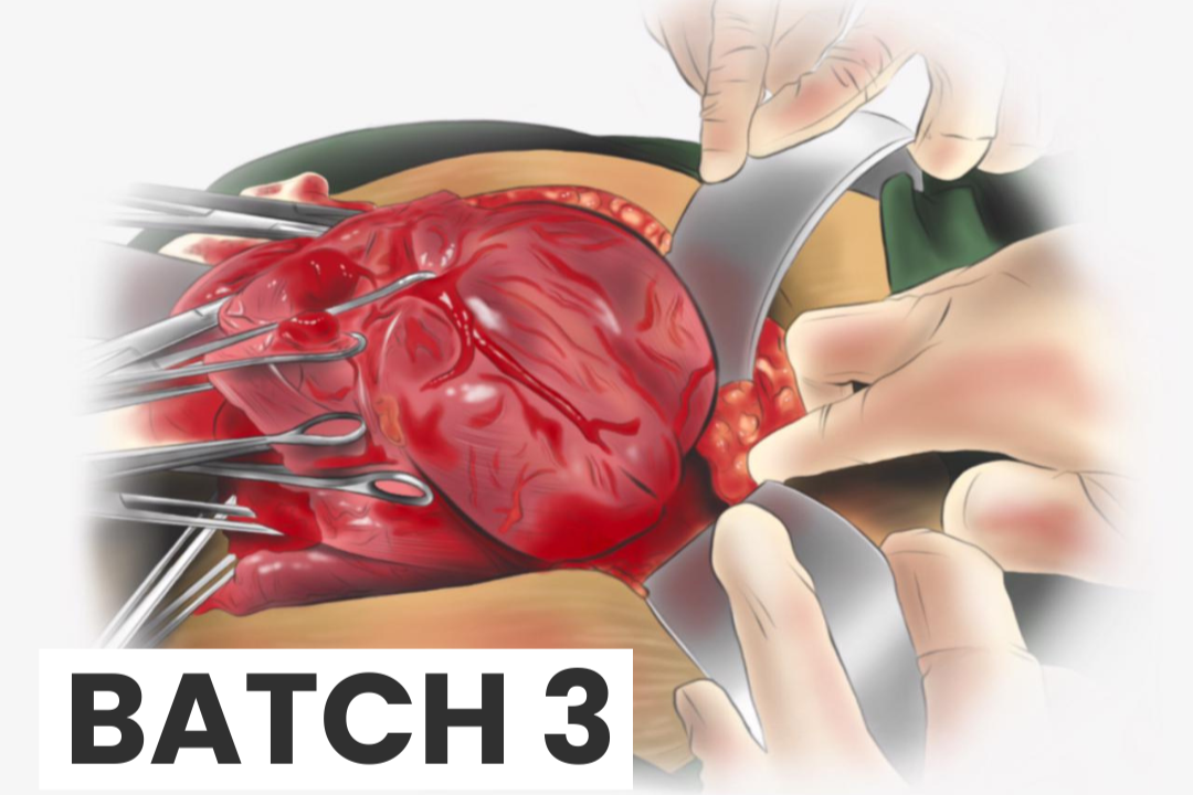 Batch 3 (2026) Advanced Course of Placenta Accreta