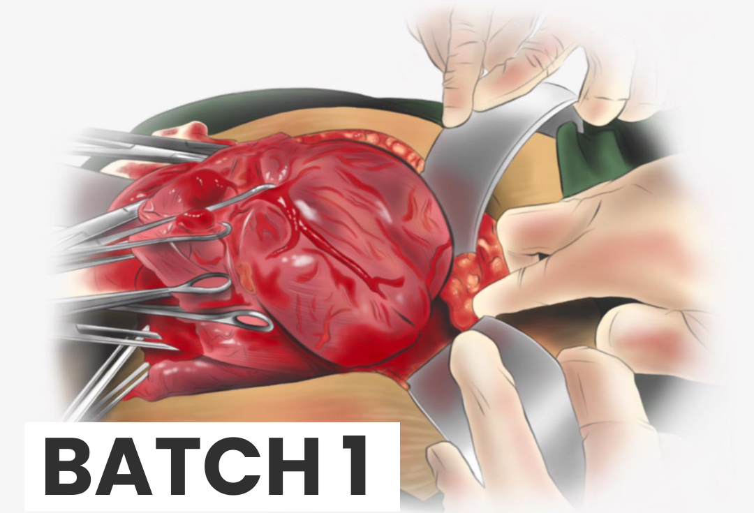Batch 1 (2026) - Advanced Course of Placenta Accreta